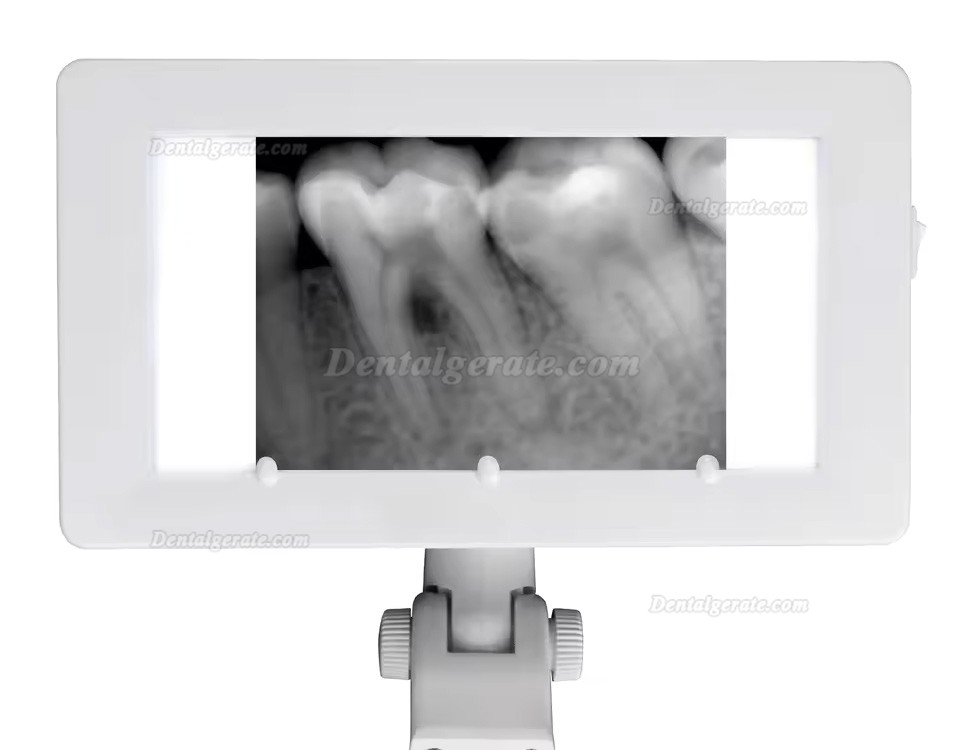 R&ouml;ntgenbildbetrachter dental, 24 V, f&uuml;r Zahnarztst&uuml;hle